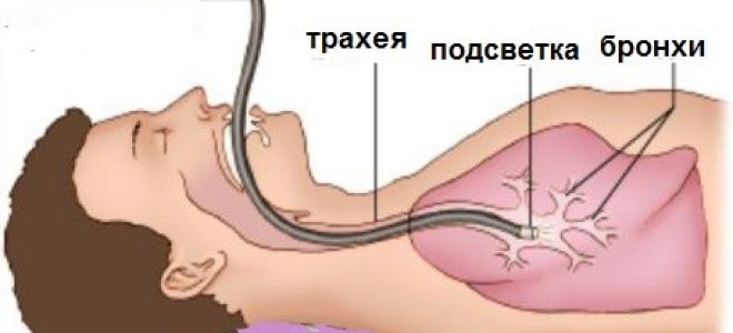Применение бронхоскопии при туберкулезе легких